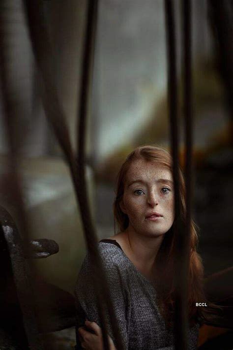 Rare facial defect doesn't stop this German model Ilka Brühl from ...