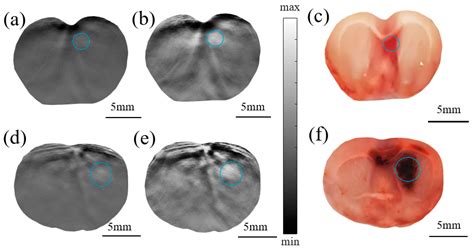 Image Enhancement Method for Photoacoustic Imaging of Deep Brain Tissue