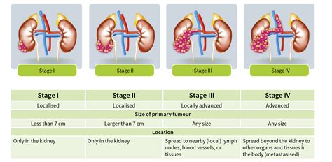 Kidney Carcinoma Staging