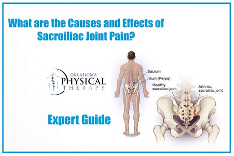 Sacroiliac joint pain: symptoms, causes, and treatment: pain when ...