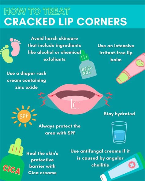 How to effectively heal cracked lip corners fast – Artofit