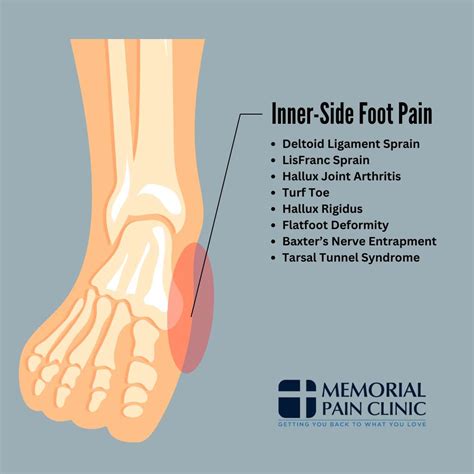 Foot Pain Chart: Common Foot Problems | Memorial Pain Clinic
