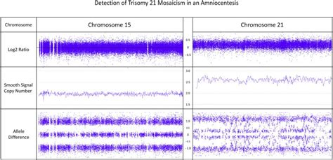 Chromosome Microarray 的图像结果