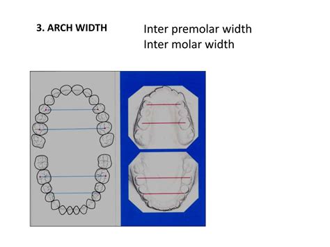 Study Cast Analysis Lac for 4th level1 .pptx | Free Download