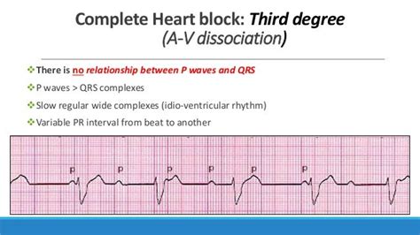 Image result for ACLS Code Blue Algorithm