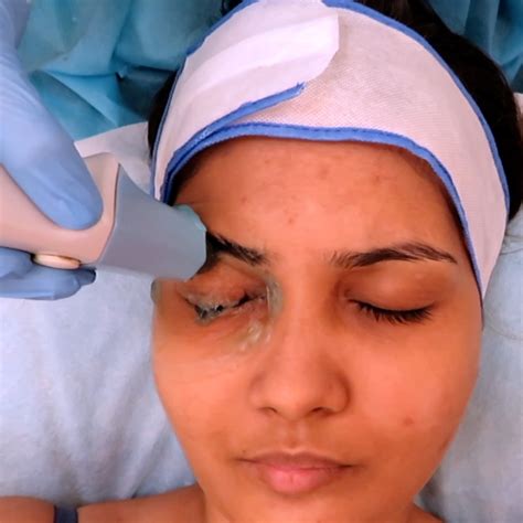 Cutis | Cutis Twinkle Eye Treatment™