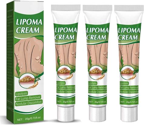 LipomaCure Soothing Ointment, LipoPRO Instant Lipoma Removal Cream, Herbal Lipoma Lumps Removal ...