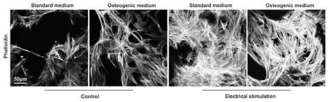 Electrical Stimulation of Adipose-Derived Stem Cells in 3D ...