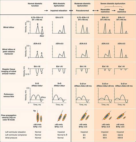 Image result for Grading Diastolic Dysfunction