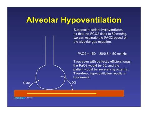 Image result for PaO2/FiO2 Alveoli