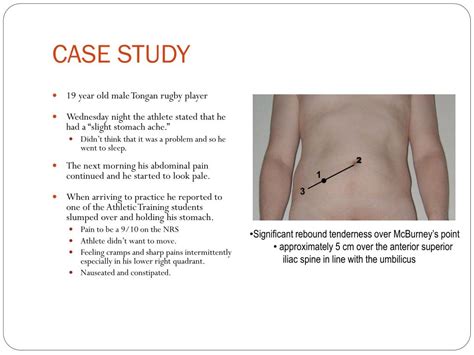 Image result for Appendicitis