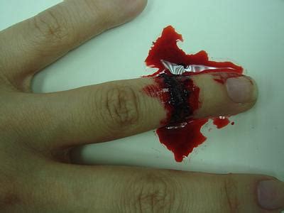 梦见自己流血 周公解梦 - 解梦吧