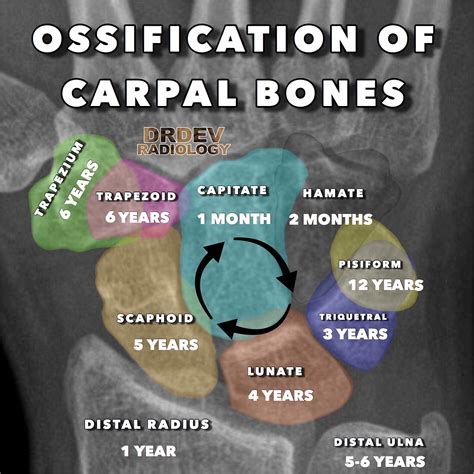 Age of Ossification of Carpal Bones Capitate - 1 Month Hamate - 2 Months Triquetral