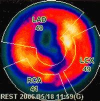 EECP Reference Guide for Angina and Heart failure treatment