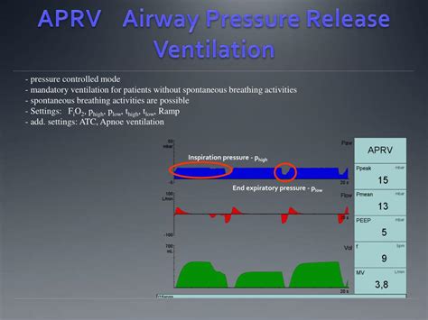 Image result for APRV Mode Explained