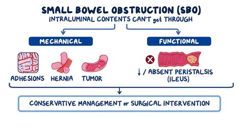 Small bowel obstruction: Video & Meaning | Osmosis