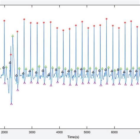 Image result for Support Vector Machines Algorithm in Machine Learning