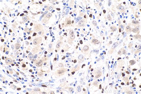 FAT10 antibody (13003-2-AP) | Proteintech