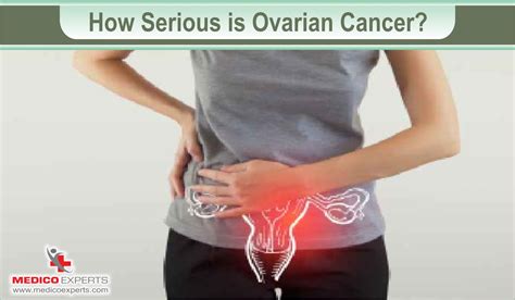 Is Ovarian Cancer Treatable? Find Out