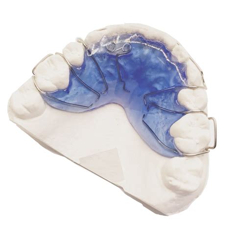 Removable-Hawley-Z-Spring - Enchanting Orthodontics Laboratory