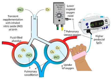 Nitric Oxide And Pulmonary Hemorrhage at Seth Darcy-irvine blog
