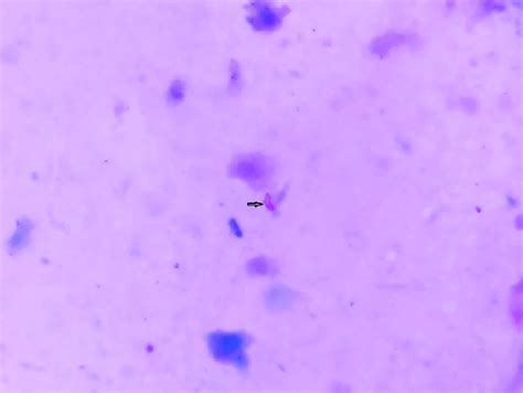 Image result for Acid-Fast Bacilli Staining Method