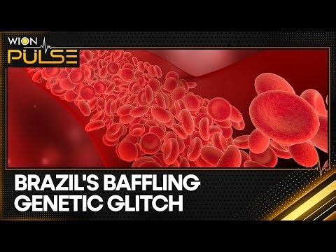 Doctors Shocked as Woman's Blood Shows XY Chromosomes | WION Pulse