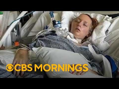 Six Flags' X2 roller coaster caused over 100 injuries, lawsuits say