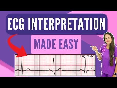 ECG Interpretation Made Easy | How to Read an ECG Rhythm Strip