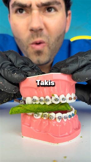Which Snack is SAFE for Braces!?