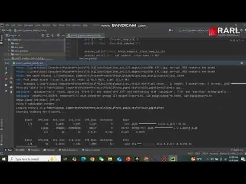 Pipeline Surface Detection Using YOLOv11 with Attention Mechanisms: SA, LKA, and CBAM. Pure Music