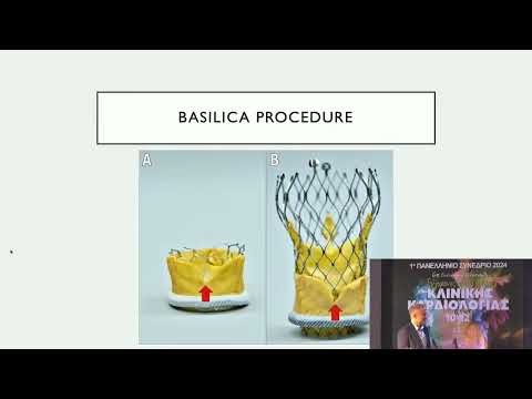 Δημήτριος Δαμάσκος. 1ο Πανελλήνιο Συνέδριο ΕΠΚΑΝ (12 Μαΐου 2024)