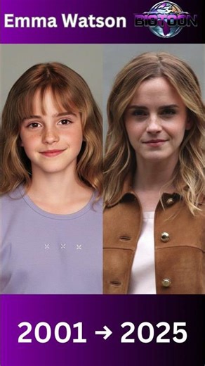 Emma Watson Through the Years (2001–2025) ✨🔥