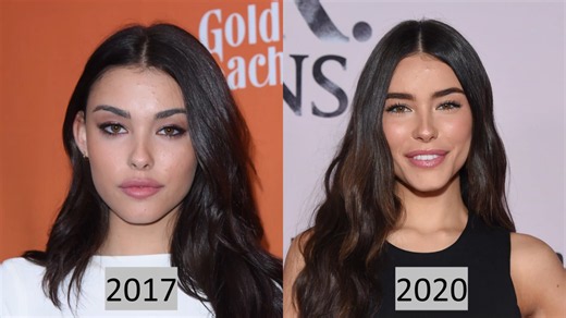 Surgeon reacts to Madison Beer’s transformation