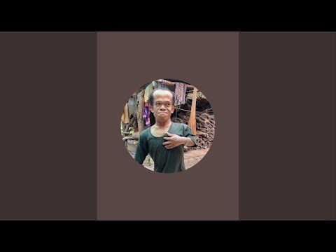 🔴 Watch the Moment 1000 Rubber Bands Destroy a Watermelon 😱 Mr 99cm Kindness