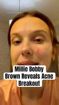 Millie Bobby Brown Reveals Acne Breakout #shorts #strangerthings #milliebobbybrown
