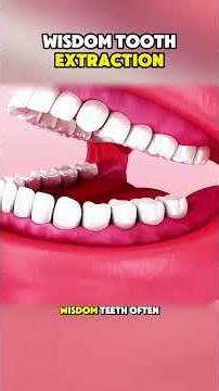 Why Your Wisdom Teeth Need to Go 🦷 🇱🇷 (Best for Curiosity)