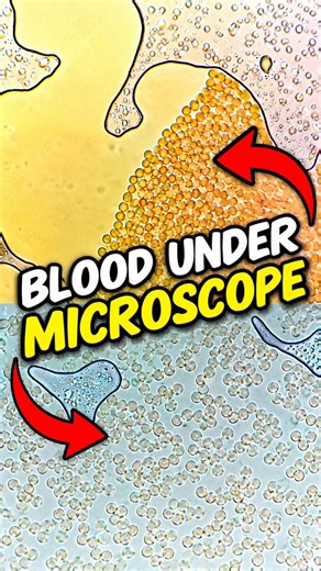 What Blood REALLY Looks Like Under a Microscope!