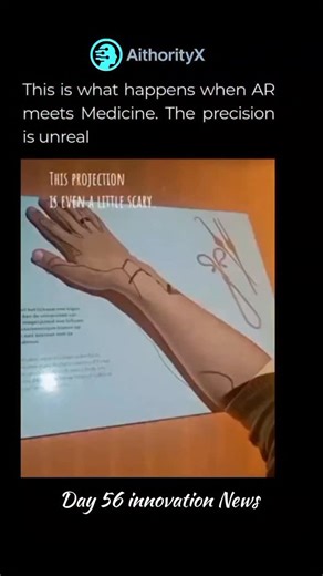 AithorityX on Instagram: "Augmented reality vein-finder devices use near‑infrared light and tiny projectors to map the veins under your skin and then beam that map back onto your arm in real time, so nurses see exactly where to place the needle. Because hemoglobin absorbs infrared light differently than surrounding tissue, these scanners reveal veins, valves, and branches that are invisible to the naked eye, cutting missed sticks, pain, and procedure time for patients. Follow @aithorityx to watc