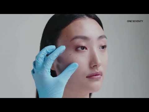 Cheek Filler Cost in Dallas, TX | Is It Worth It?