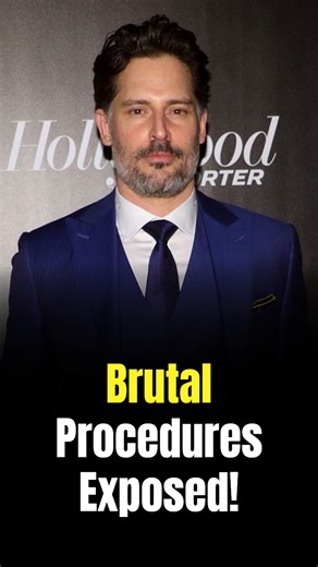 Joe Manganiello recalls brutal procedures that left him unable to walk during secret health battle