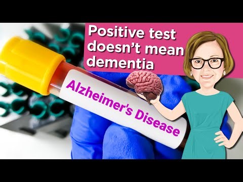 Before You Panic About Alzheimer’s Test, Watch This