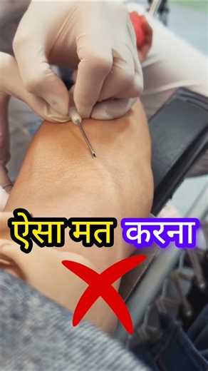 IV Cannulation