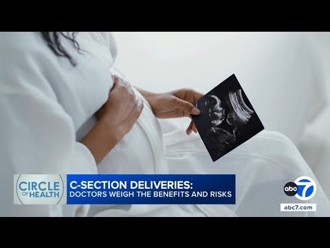 C-section rates in US remain high as experts weigh risks and benefits