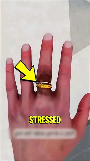 Ring Stuck on Your Finger Try This Simple Trick! 💍