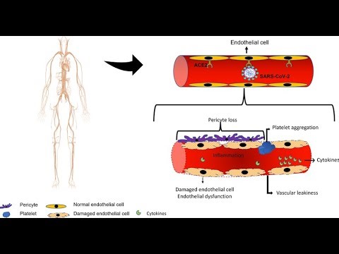Vascular damage and cell death Due to Infections; pathogens and the body’s immune response disrupt