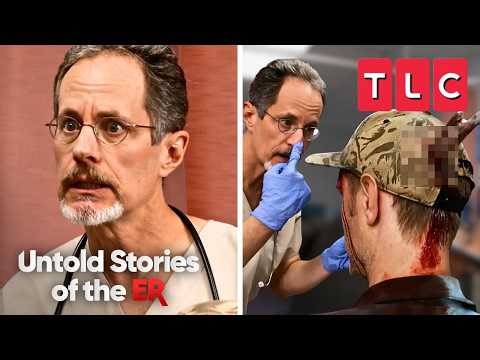 The Most UNUSUAL Cases 🚑 🩻 | Untold Stories of the ER | TLC