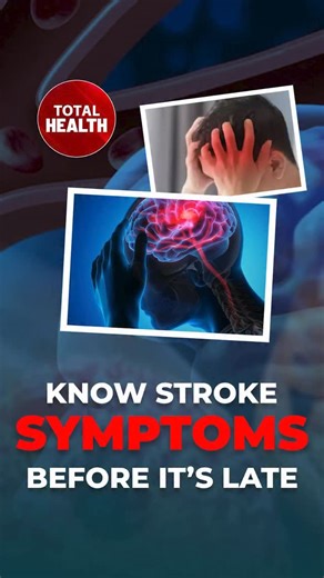 #TotalHealth | Is stroke limited to those over 60? Do stress and lack of sleep weaken the brain? Can early symptom recognition save a life? Know more from Renowned Neurologist Padma Shri Dr. M.V. Padma Srivastava on the Total Health Podcast. Watch the full show: youtu.be/KcEv6cvDbto @mohfwindia #TotalHealthPodcast #BrainHealth #StrokeAwareness #NeuroHealth MentalHealth HealthyBrain PreventiveHealth HealthAwareness | DDNewsLive