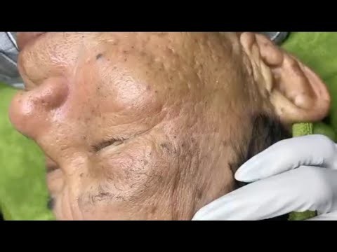 Sac Dep Spa Care — Clear & Healthy Skin Journey ✨