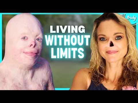 4 People Proving Beauty Has No Rules | SHAKE MY BEAUTY